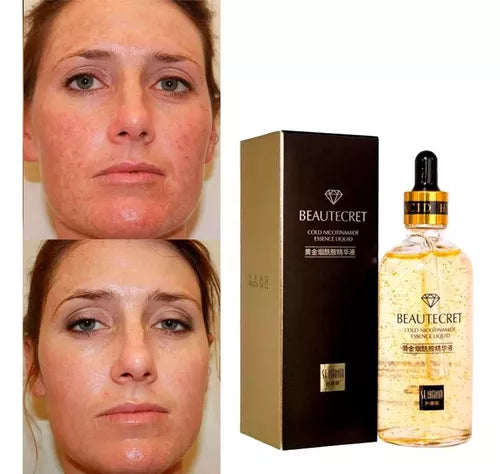 Serum 18k